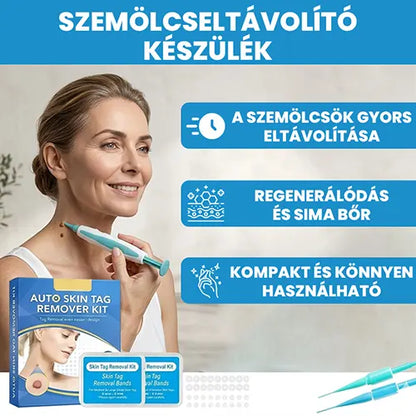 Professzionális szemölcseltávolító készülék – minden bőrtípusra alkalmas