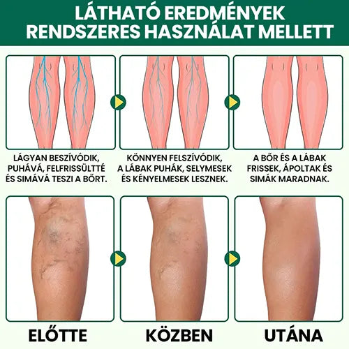 Természetes Fájdalomcsillapító Krém – Csökkenti a nehéz és fáradt láb érzését, a gyulladást és a diszkomfortot