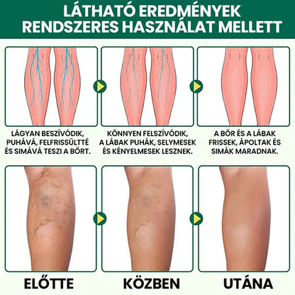 Természetes Fájdalomcsillapító Krém – Csökkenti a nehéz és fáradt láb érzését, a gyulladást és a diszkomfortot
