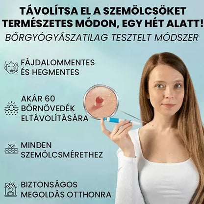 Professzionális szemölcseltávolító készülék – minden bőrtípusra alkalmas